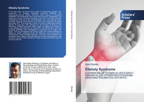 Elbeialy Syndrome: A SYNDROME OF VITAMIN D3 DEFICIENCY/ FIBROMYALGIA/ HYPERPARATHYROIDISM MIMICKING RHEUMATOID ARTHRITIS