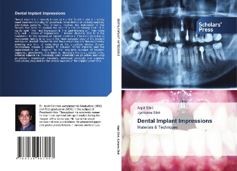 Dental Implant Impressions: Materials & Techniques