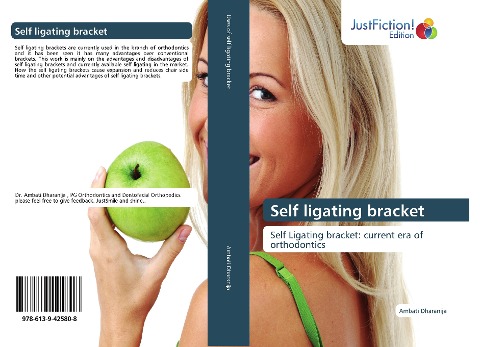 Self ligating bracket: Self Ligating bracket: current era of orthodontics