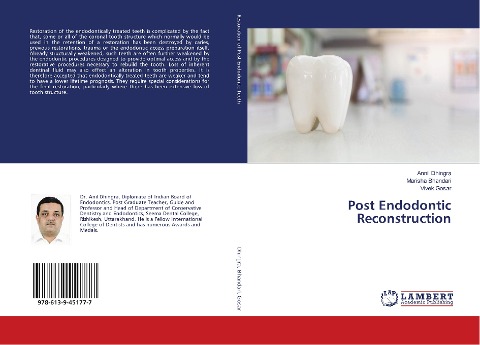Post Endodontic Reconstruction