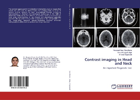 Contrast imaging in Head and Neck: An important Diagnostic tool
