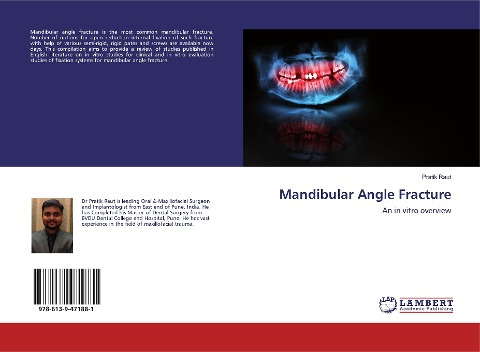 Mandibular Angle Fracture: An in vitro overview