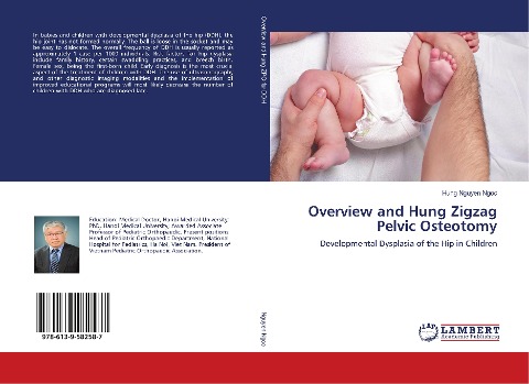 Overview and Hung Zigzag Pelvic Osteotomy: Developmental Dysplasia of the Hip in Children