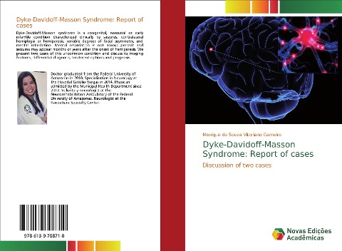 Dyke-Davidoff-Masson Syndrome: Report of cases: Discussion of two cases
