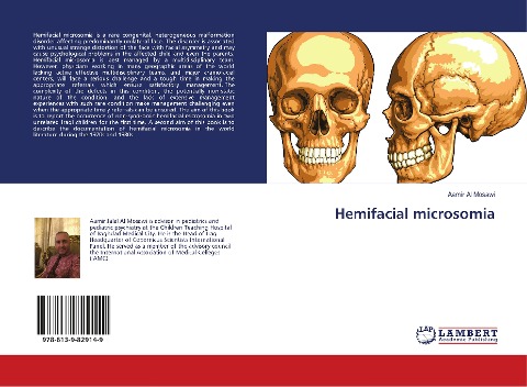Hemifacial microsomia