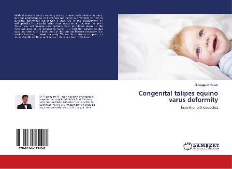 Congenital talipes equino varus deformity: Essential orthopaedics
