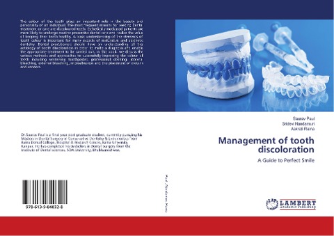 Management of tooth discoloration: A Guide to Perfect Smile