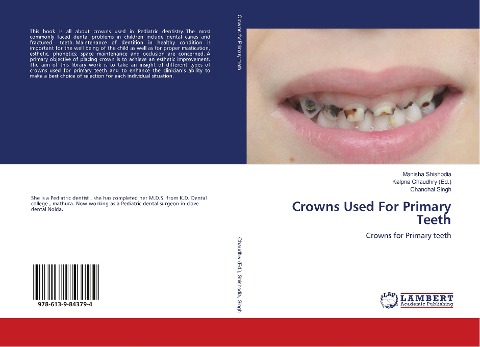 Crowns Used For Primary Teeth: Crowns for Primary teeth
