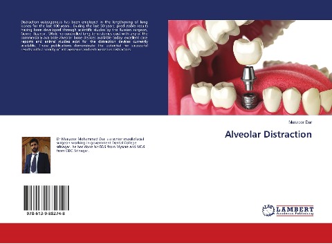 Alveolar Distraction