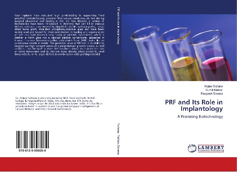 PRF and Its Role in Implantology: A Promising Biotechnology