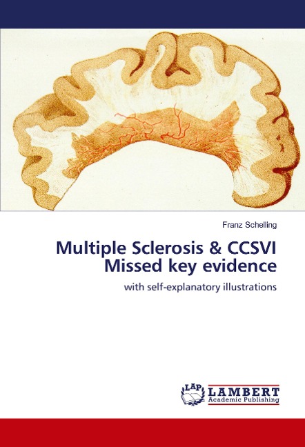 Multiple Sclerosis & CCSVI Missed key evidence: with self-explanatory illustrations