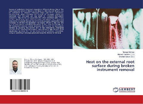 Heat on the external root surface during broken instrument removal