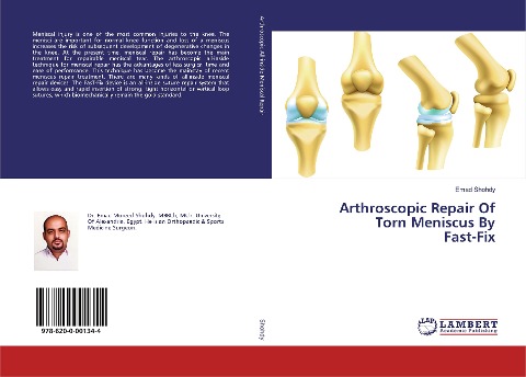 Arthroscopic Repair Of Torn Meniscus By Fast-Fix