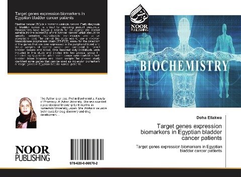 Target genes expression biomarkers in Egyptian bladder cancer patients: Target genes expression biomarkers in Egyptian bladder cancer patients
