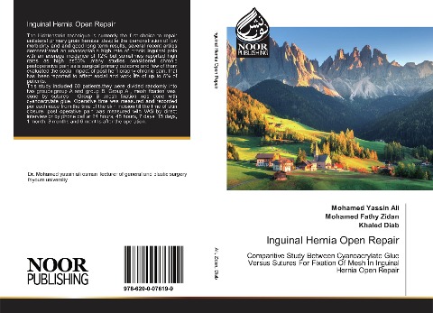 Inguinal Hernia Open Repair: Comparitive Study Between Cyanoacrylate Glue Versus Sutures For Fixation Of Mesh In Inguinal Hernia Open Repair