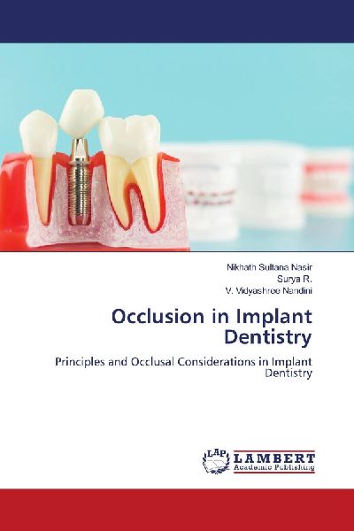 Occlusion in Implant Dentistry: Principles and Occlusal Considerations in Implant Dentistry