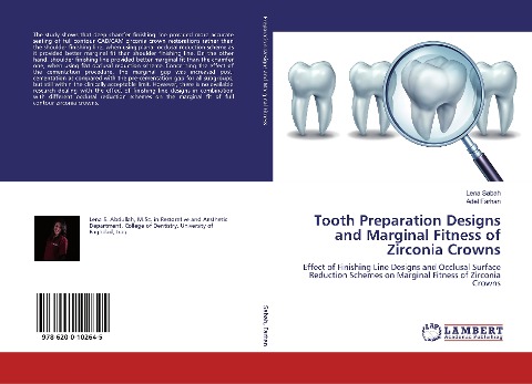 Tooth Preparation Designs and Marginal Fitness of Zirconia Crowns: Effect of Finishing Line Designs and Occlusal Surface Reduction Schemes on Marginal Fitness of Zirconia Crowns