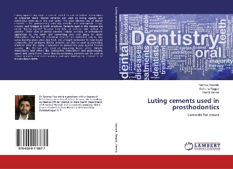 Luting cements used in prosthodontics: Cements for crown