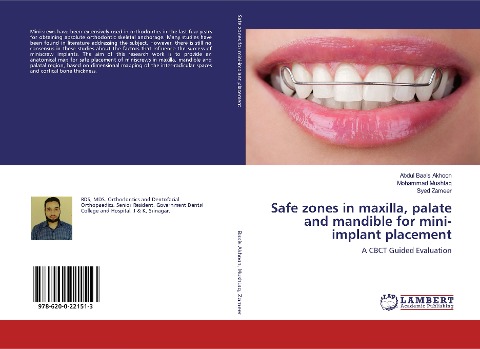 Safe zones in maxilla, palate and mandible for mini-implant placement: A CBCT Guided Evaluation