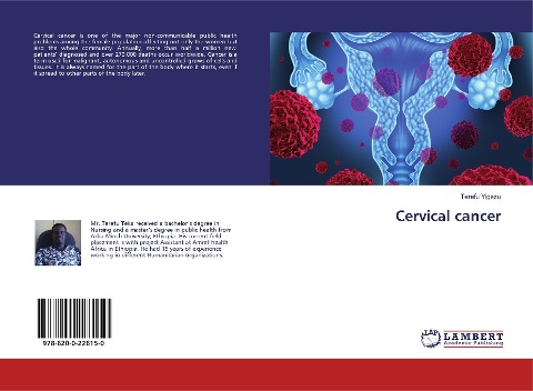 Cervical cancer