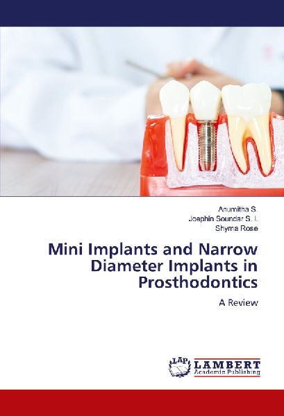 Mini Implants and Narrow Diameter Implants in Prosthodontics: A Review