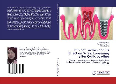 Implant Factors and Its Effect on Screw Loosening after Cyclic Loading: Effect of Implant Abutment Connection Designs, Implant Diameters and Types of Abutment on Screw Loosening