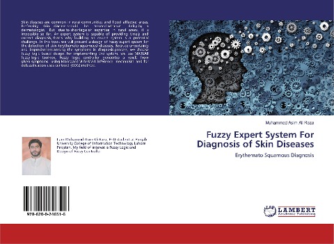 Fuzzy Expert System For Diagnosis of Skin Diseases: Erythemato Squamous Diagnosis