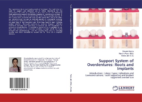 Support System of Overdentures: Roots and Implants: Introduction; History; Types; Indications and Contraindications; Tooth supported and Implant supported overdenture