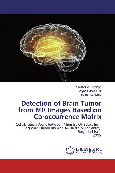 Detection of Brain Tumor from MR Images Based on Co-occurrence Matrix: Collabration Work between Ministry Of Education, Baghdad University and Al-Nahrain University. Baghdad Iraq. 2019