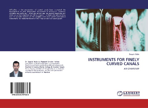 INSTRUMENTS FOR FINELY CURVED CANALS: AN OVERVIEW