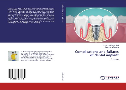 Complications and failures of dental implant: A review