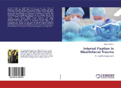 Internal Fixation in Maxillofacial Trauma: A simplified approach