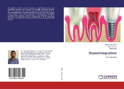 Osseointegration: An overview