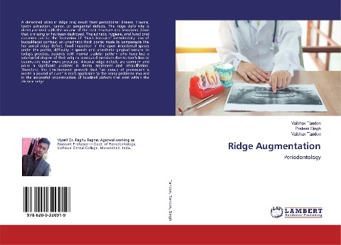 Ridge Augmentation: Periodontology