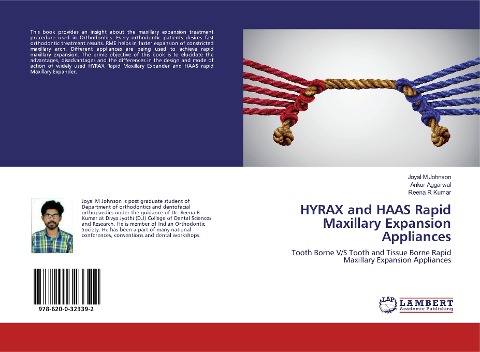 HYRAX and HAAS Rapid Maxillary Expansion Appliances: Tooth Borne V/S Tooth and Tissue Borne Rapid Maxillary Expansion Appliances