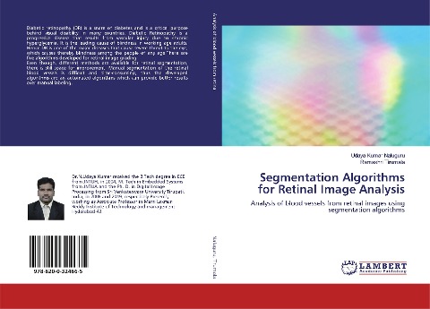 Segmentation Algorithms for Retinal Image Analysis: Analysis of blood vessels from retinal images using segmentation algorithms