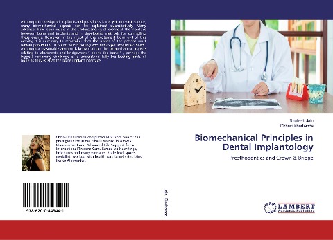 Biomechanical Principles in Dental Implantology: Prosthodontics and Crown & Bridge