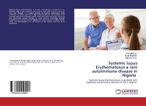 Systemic lupus Erythematosus a rare autoimmune disease in Nigeria: Systemic lupus Erythematosus in patients with suspected autoimmune diseases in Zaria, Nigeria