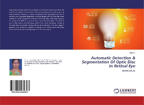 Automatic Detection & Segmentation Of Optic Disc In Retinal Eye: BIOMEDICAL