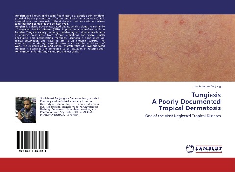 TungiasisA Poorly Documented Tropical Dermatosis: One of the Most Neglected Tropical Diseases