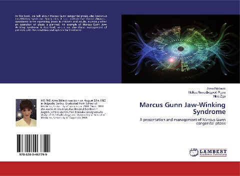 Marcus Gunn Jaw-Winking Syndrome: A presentation and management of Marcus Gunn congenital ptosis