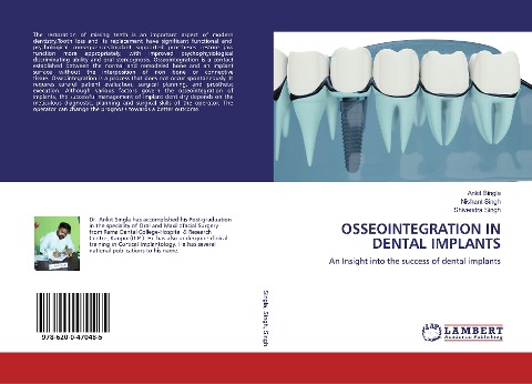 OSSEOINTEGRATION IN DENTAL IMPLANTS: An Insight into the success of dental implants