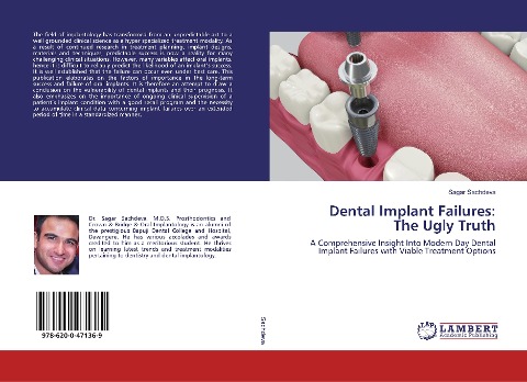 Dental Implant Failures:The Ugly Truth: A Comprehensive Insight Into Modern Day Dental Implant Failures with Viable Treatment Options