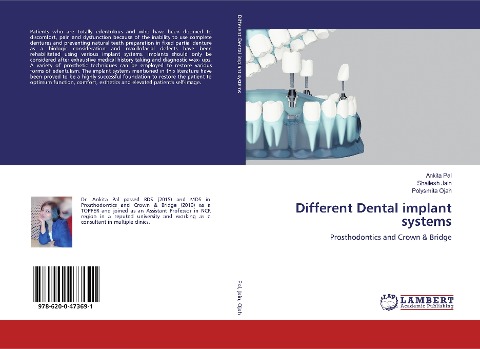 Different Dental implant systems: Prosthodontics and Crown & Bridge