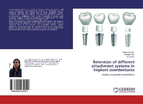 Retention of different attachment systems in implant overdentures: Implant supported overdentures