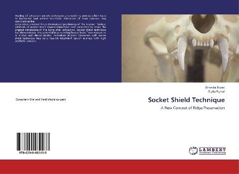 Socket Shield Technique: A New Concept of Ridge Preservation