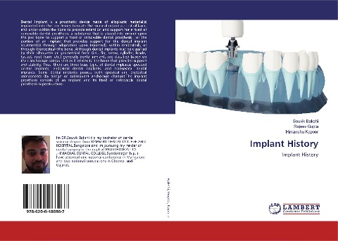 Implant History: Implant History