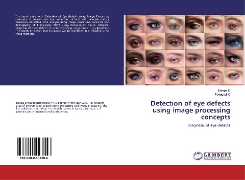 Detection of eye defects using image processing concepts: Diagnosis of eye defects