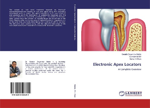 Electronic Apex Locators: A Complete Overview