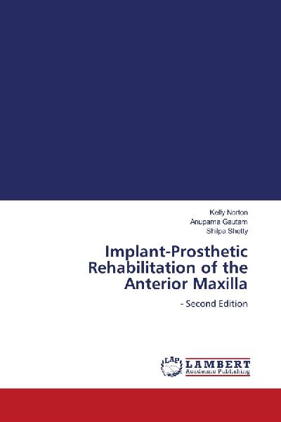 Implant-Prosthetic Rehabilitation of the Anterior Maxilla: - Second Edition